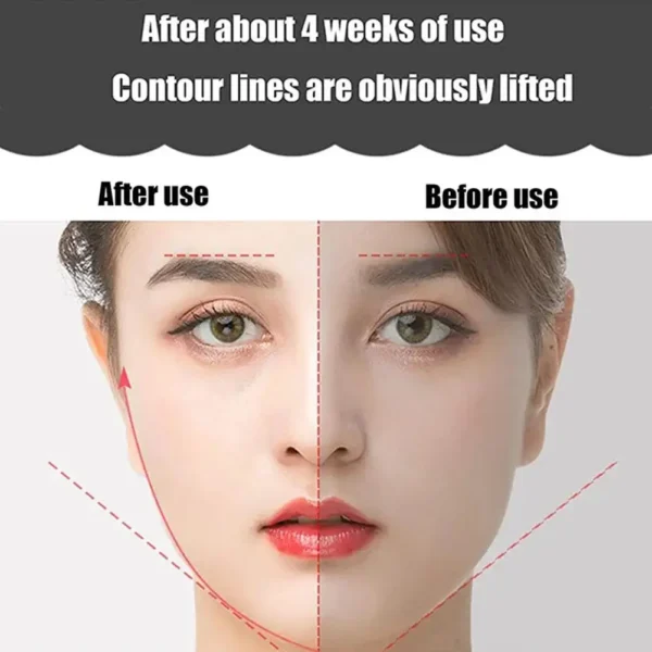 Y Shape Face Lifting Device V Face Double Chin Remover Face Care Skin